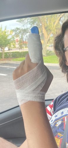 YARENH Cleaver Knife Set with Magnetic Block, Damascus Stainless Steel,73 Layers, 5 Piece Professional Sharp Kitchen Knife Set for Chef, Full Tang, Sandalwood Wood Handle photo review